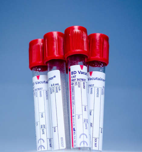 Blood test to predict suicide?