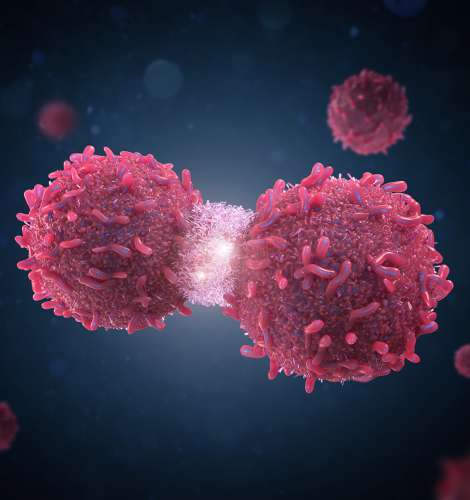 Significant global increases in new cancer cases and deaths expected